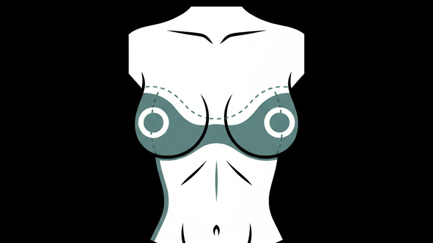 les cicatrices d'un lifting des seins